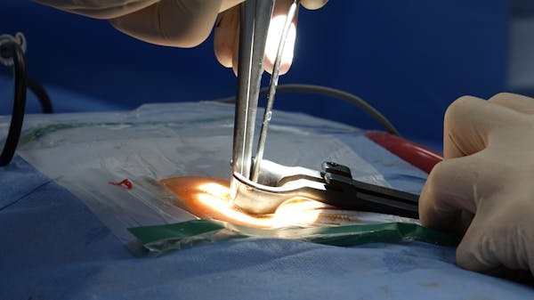 Hernie discale à aubagne : vos solutions personnalisées pour guérir